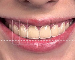 Closeup of patient's smile with design animation