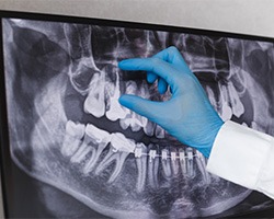 a dentist looking at an X-ray